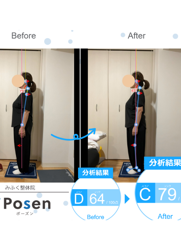姿勢分析ビフォーアフター ケース01 D64からC79に改善