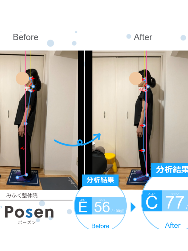 姿勢分析ビフォーアフター ケース02 E56からC77に改善